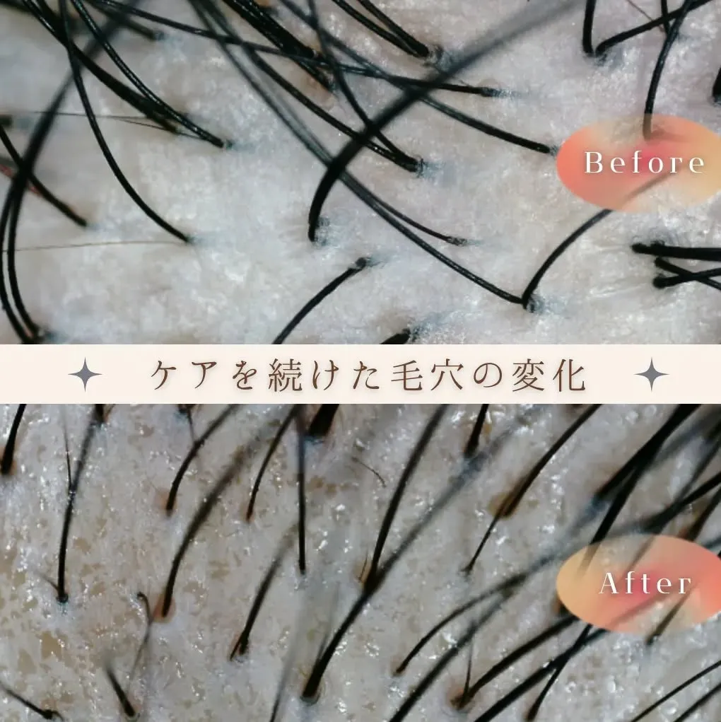 一目でわかる毛穴の変化