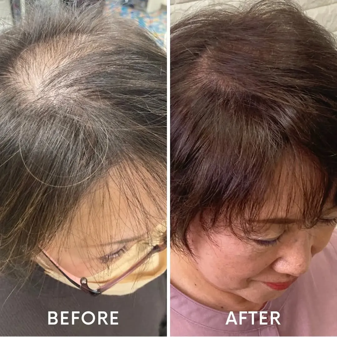 髪の老化予防は簡単なことから始められる！