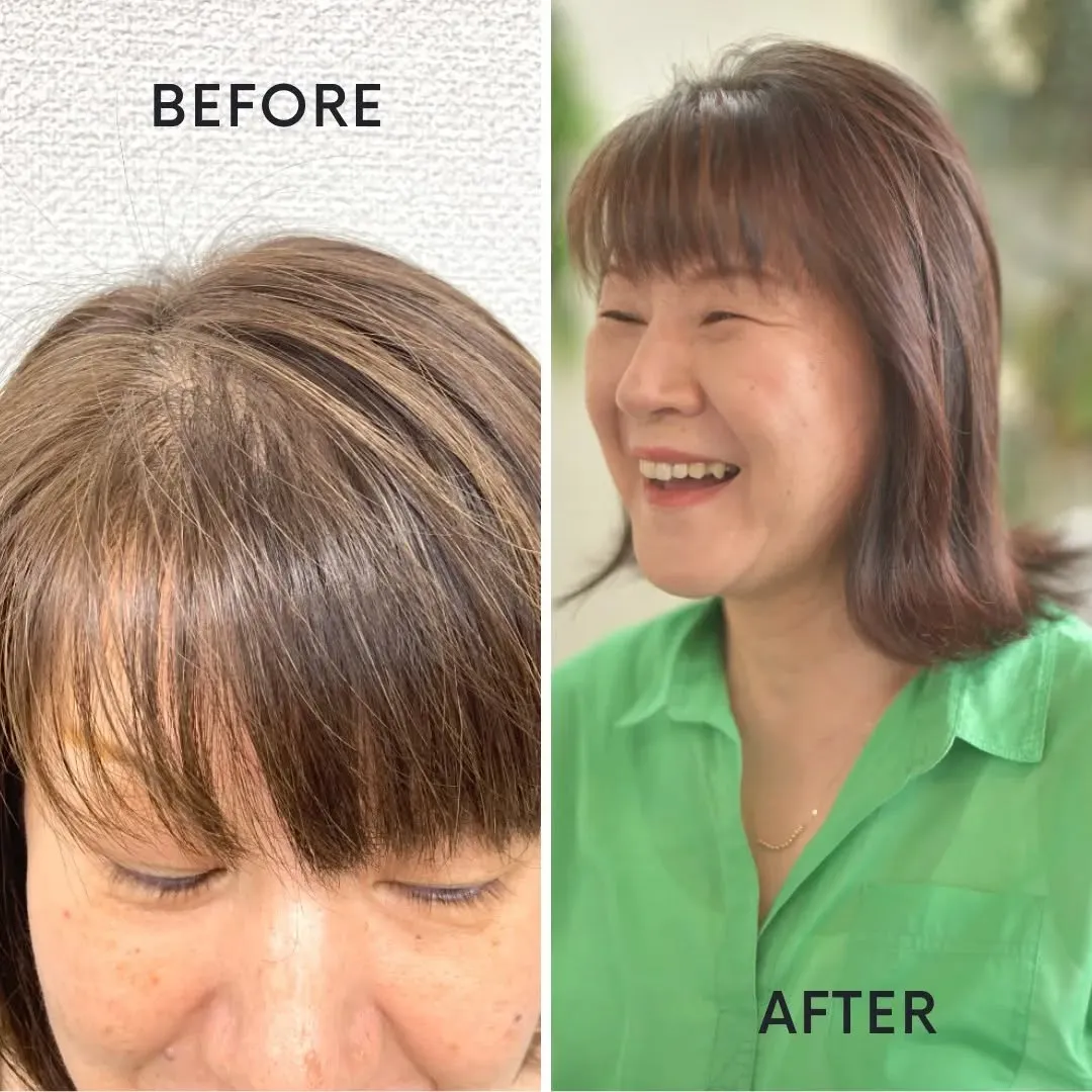 食事生活の改善から少しずつ始める #発毛