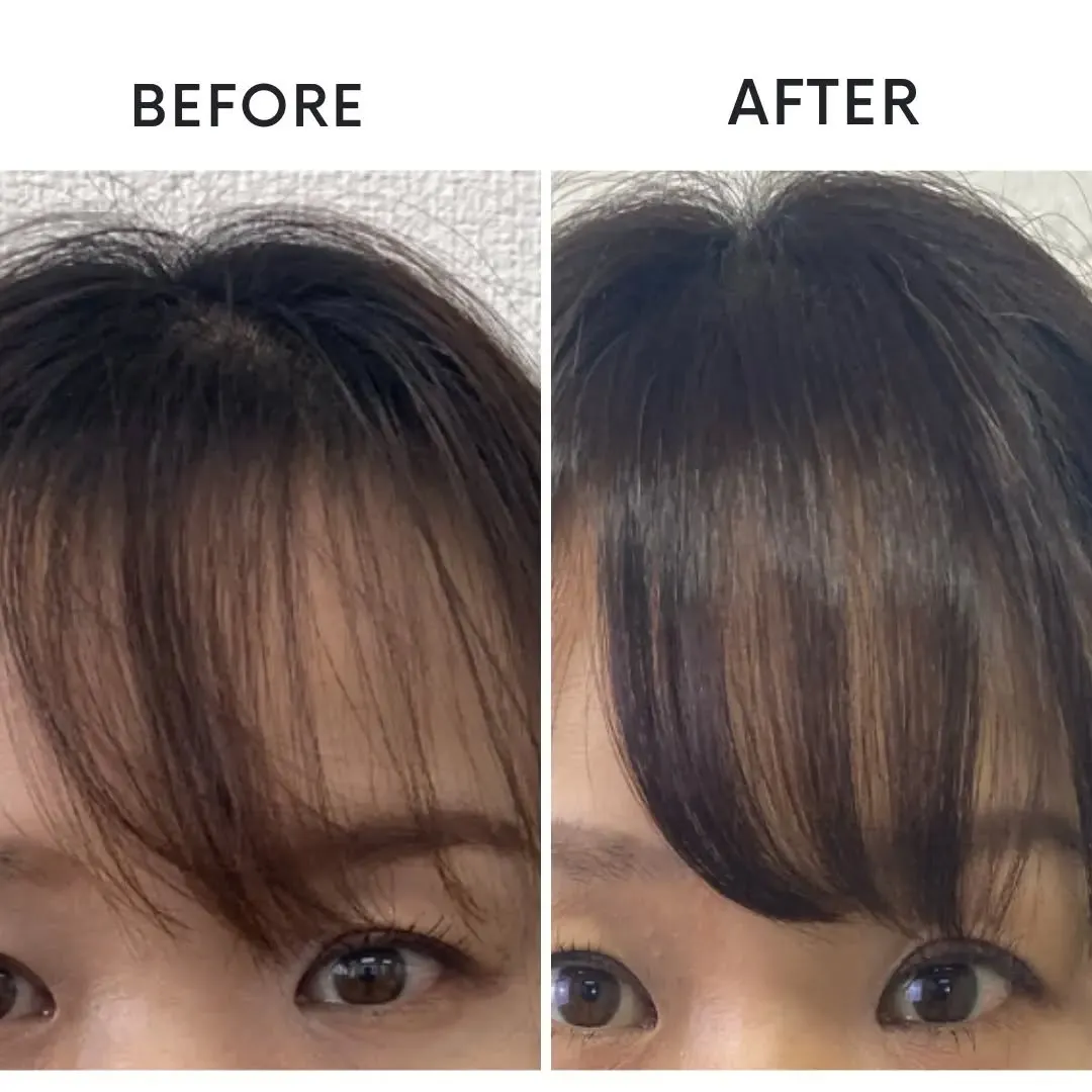 髪は生えてきます✨